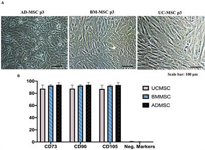 Differential Wound Healing Capacity of Mesenchymal Stem Cell-Derived Exosomes Originated From Bone Marrow, Adipose Tissue and Umbilical Cord Under Serum- and Xeno-Free Condition